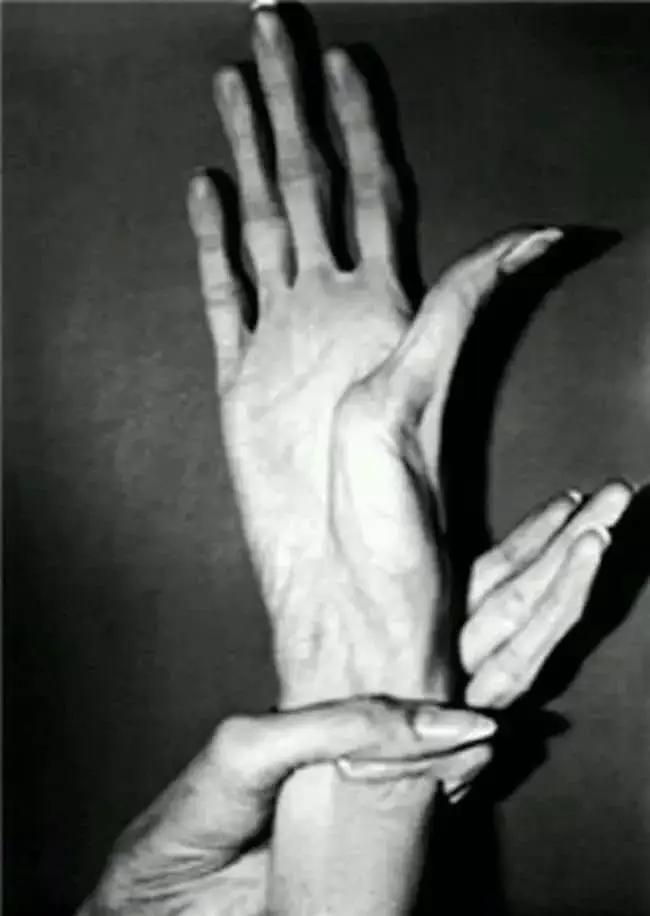 Les mains déformés de Tsutomu Moyazaki